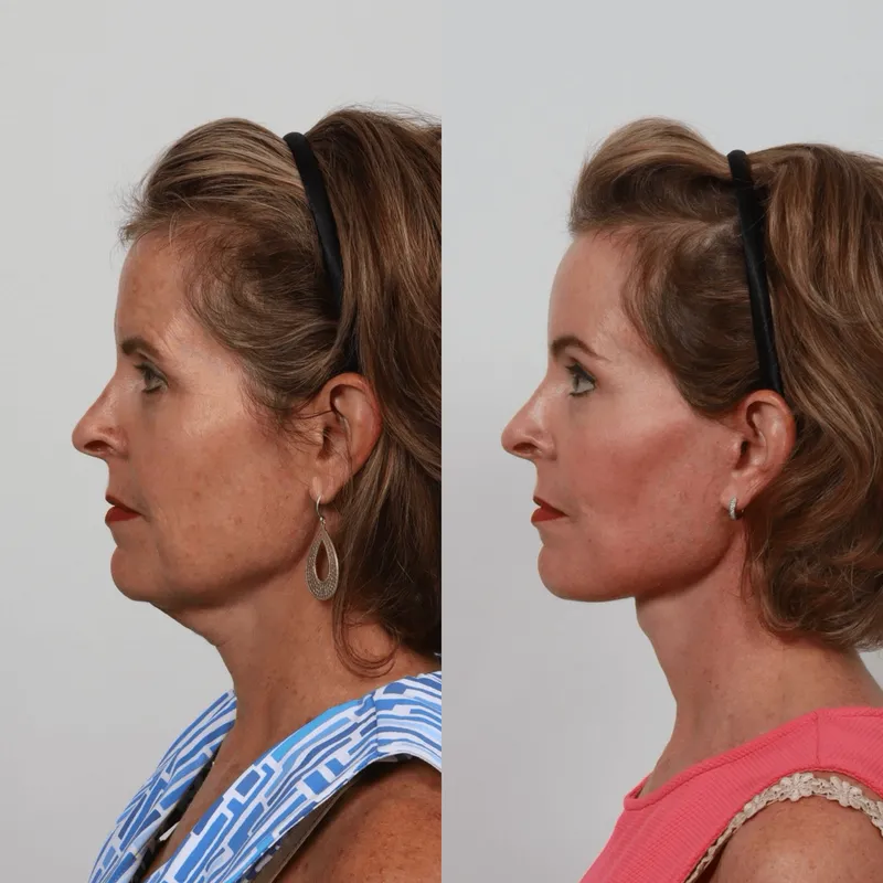 Before and after: Dr. Garrett Locketz