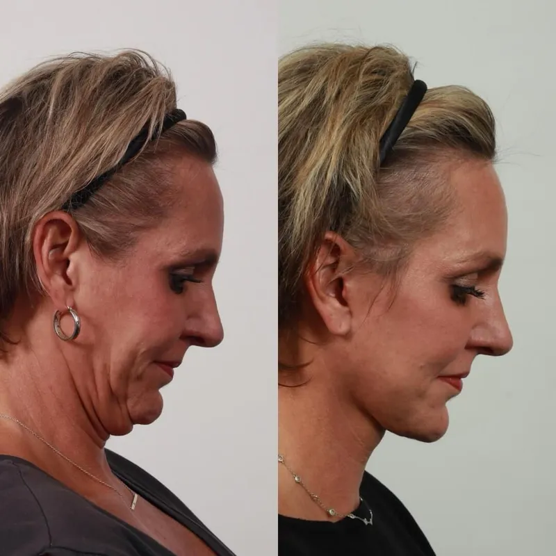Before and after: Dr. Garrett Locketz