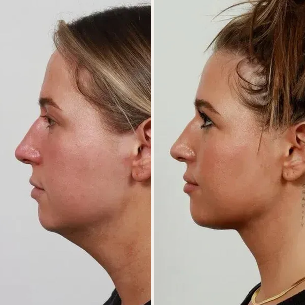 Before and after: Dr. Garrett Locketz