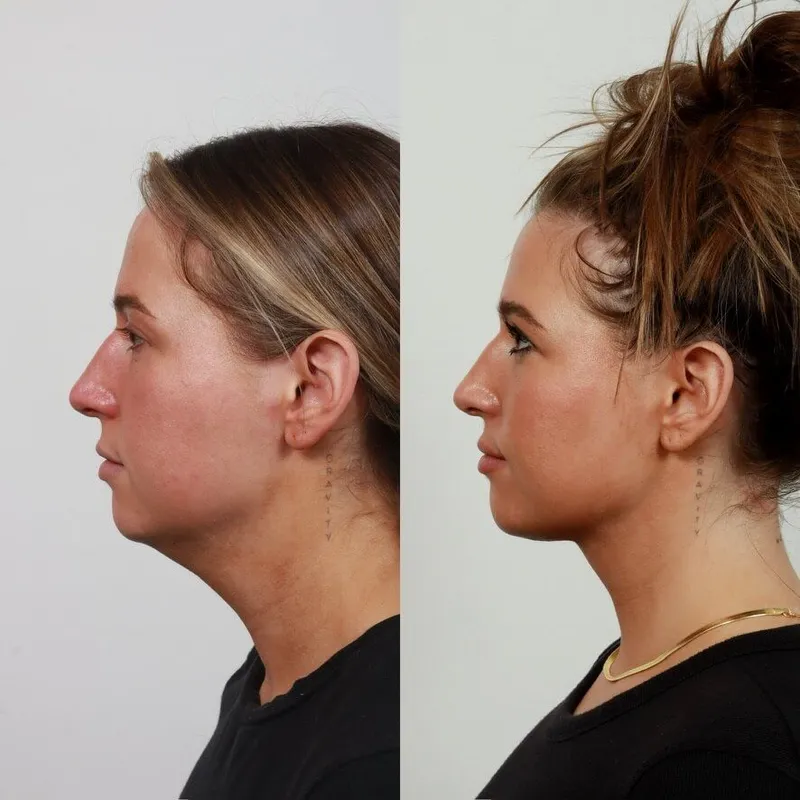 Before and after: Dr. Garrett Locketz