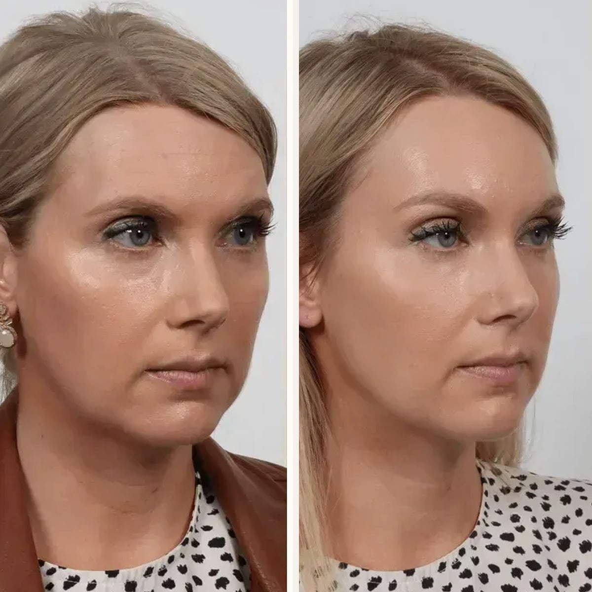 Before and after: Dr. Garrett Locketz