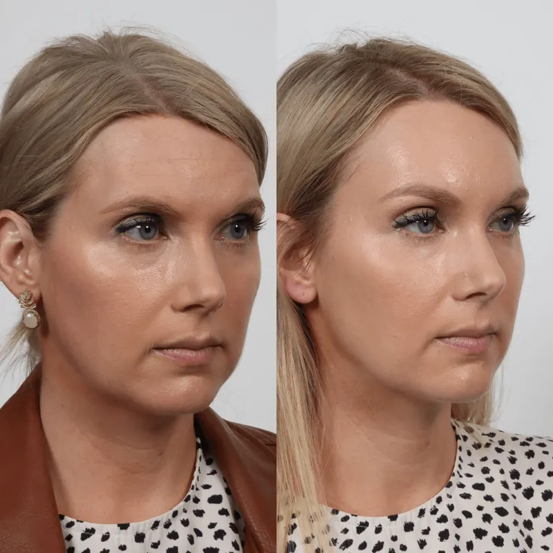 Before and after: Dr. Garrett Locketz