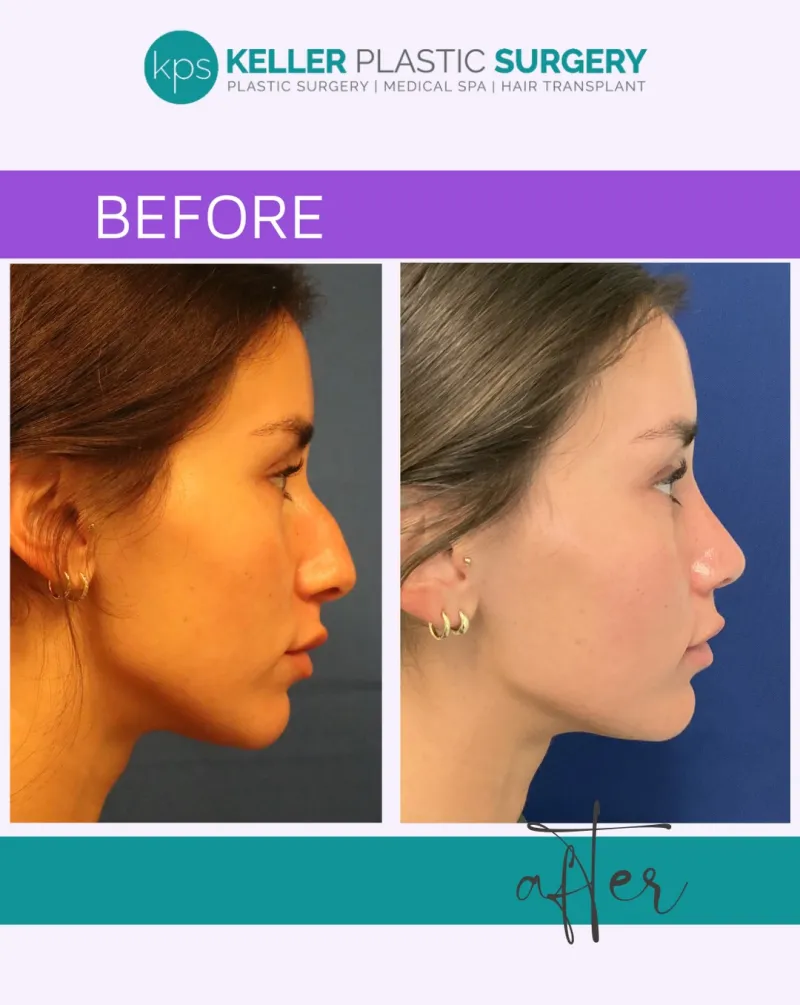 Before and after — Dr. Gregory Keller