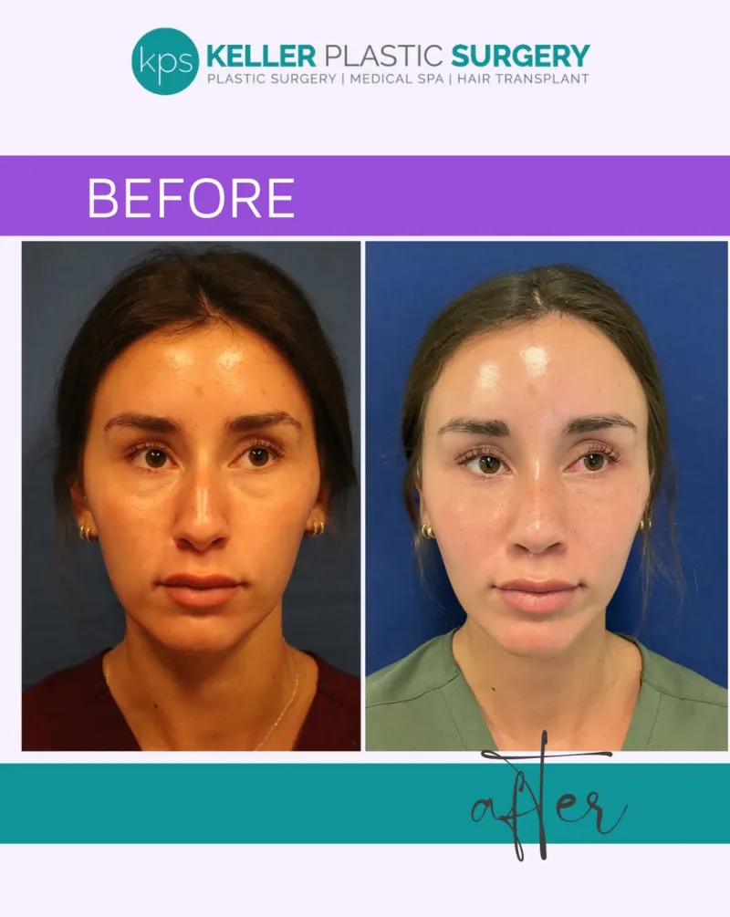 Before and after — Dr. Gregory Keller