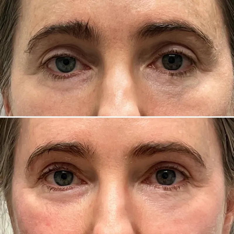 Before and after — Dr. Guy Massry
