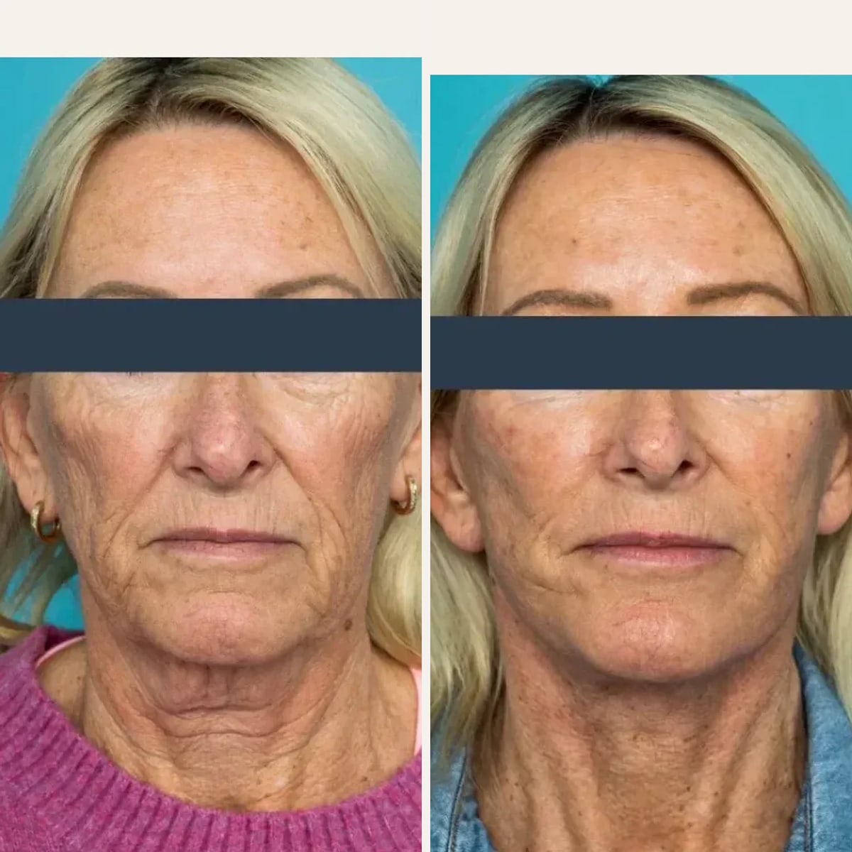 Before and after: Dr. Guy Watts