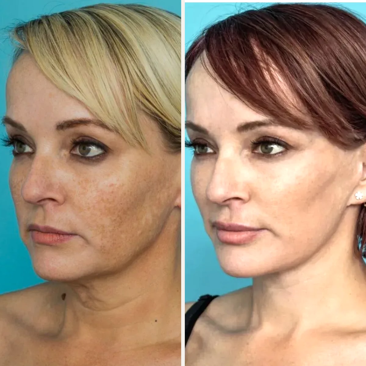Before and after: Dr. Guy Watts