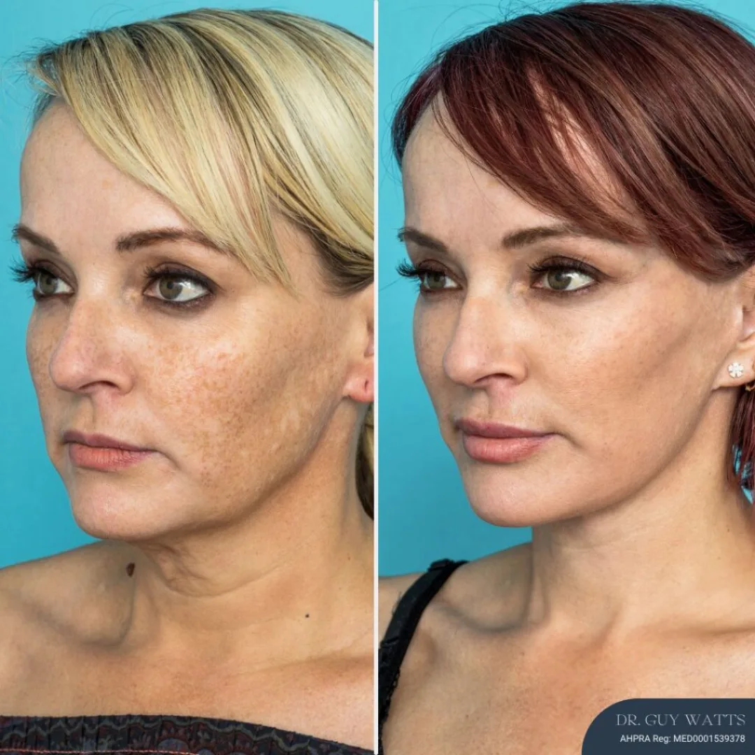Before and after — Dr. Guy Watts