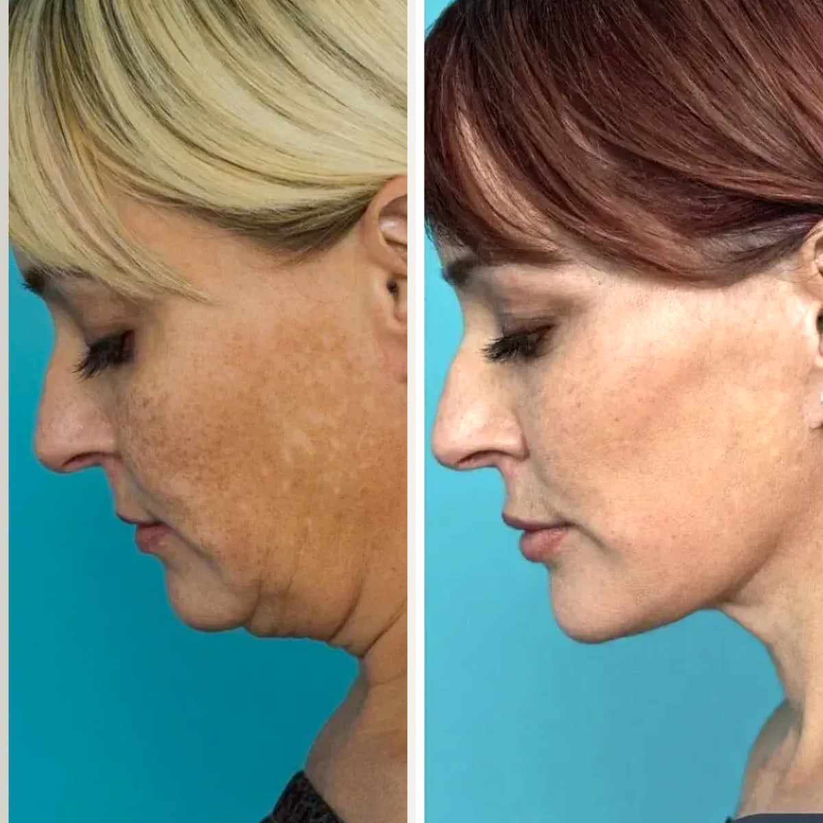 Before and after: Dr. Guy Watts