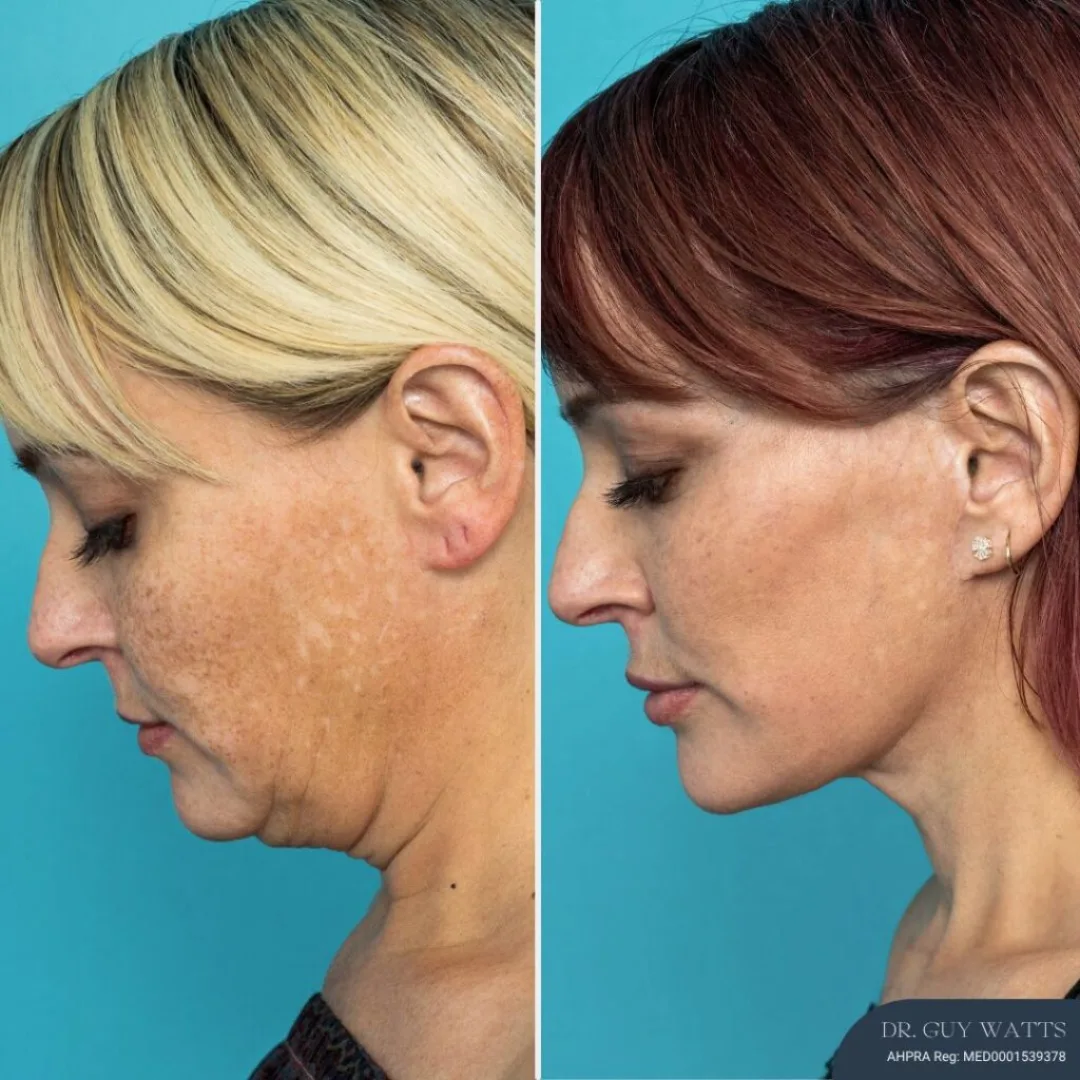 Before and after — Dr. Guy Watts