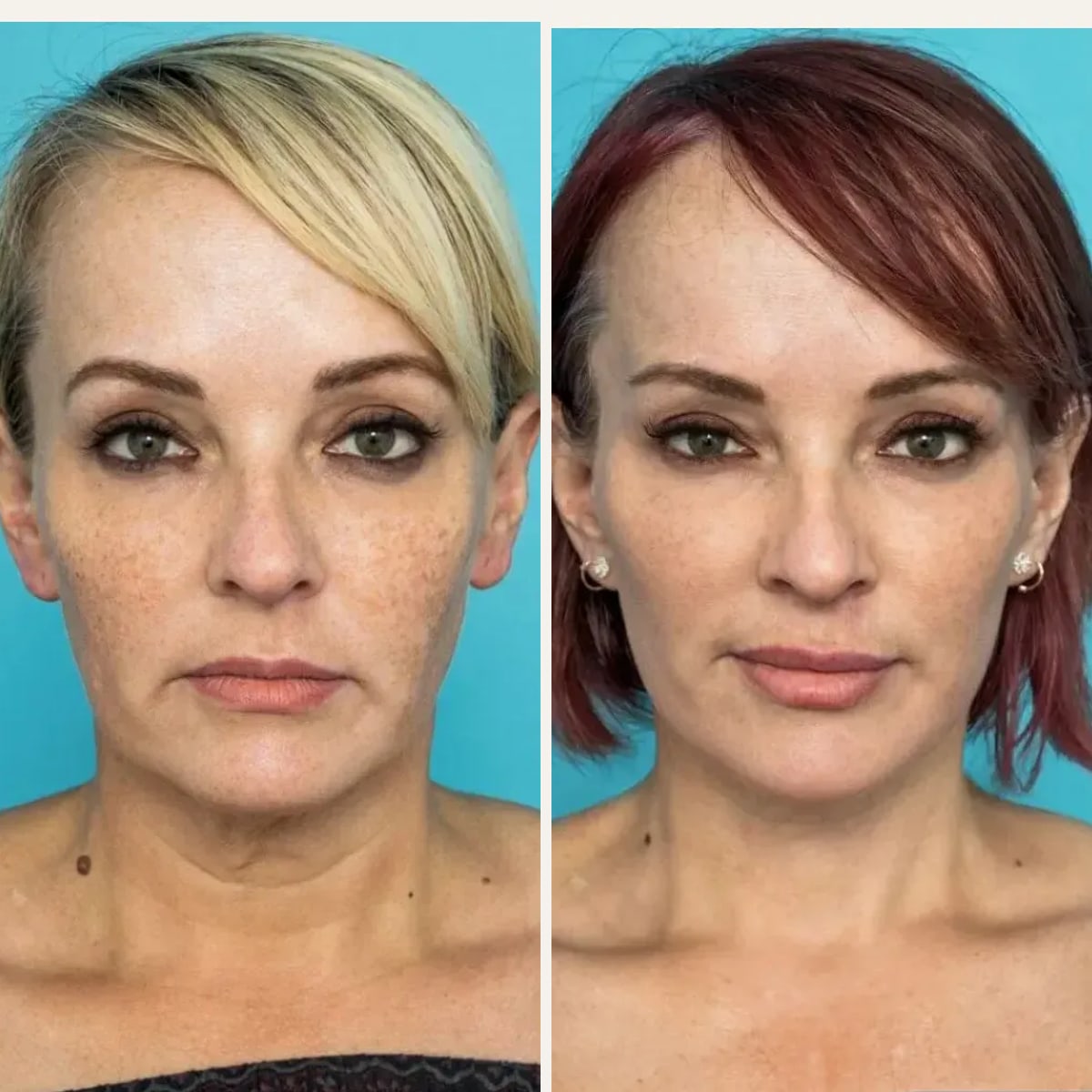 Before and after: Dr. Guy Watts