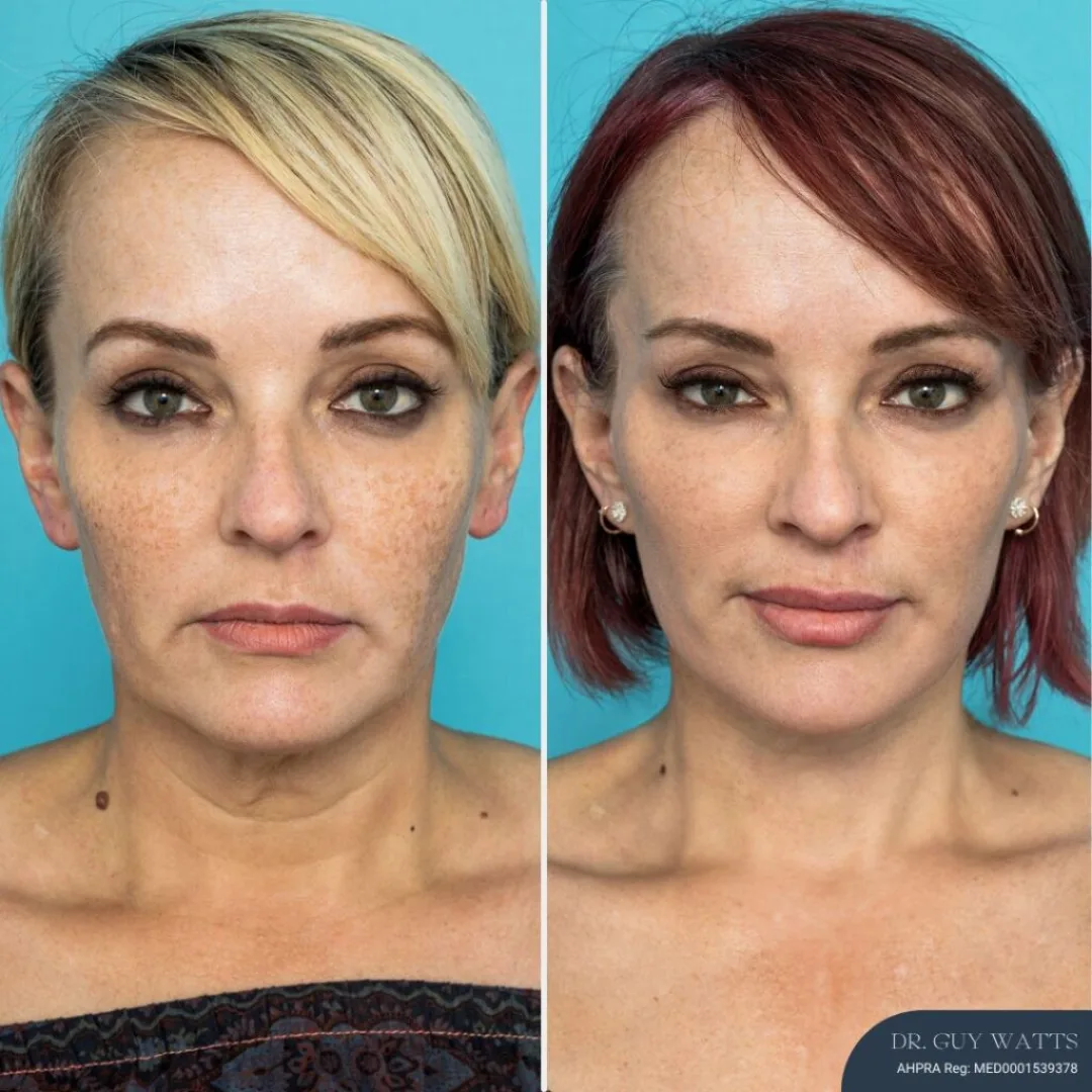 Before and after — Dr. Guy Watts