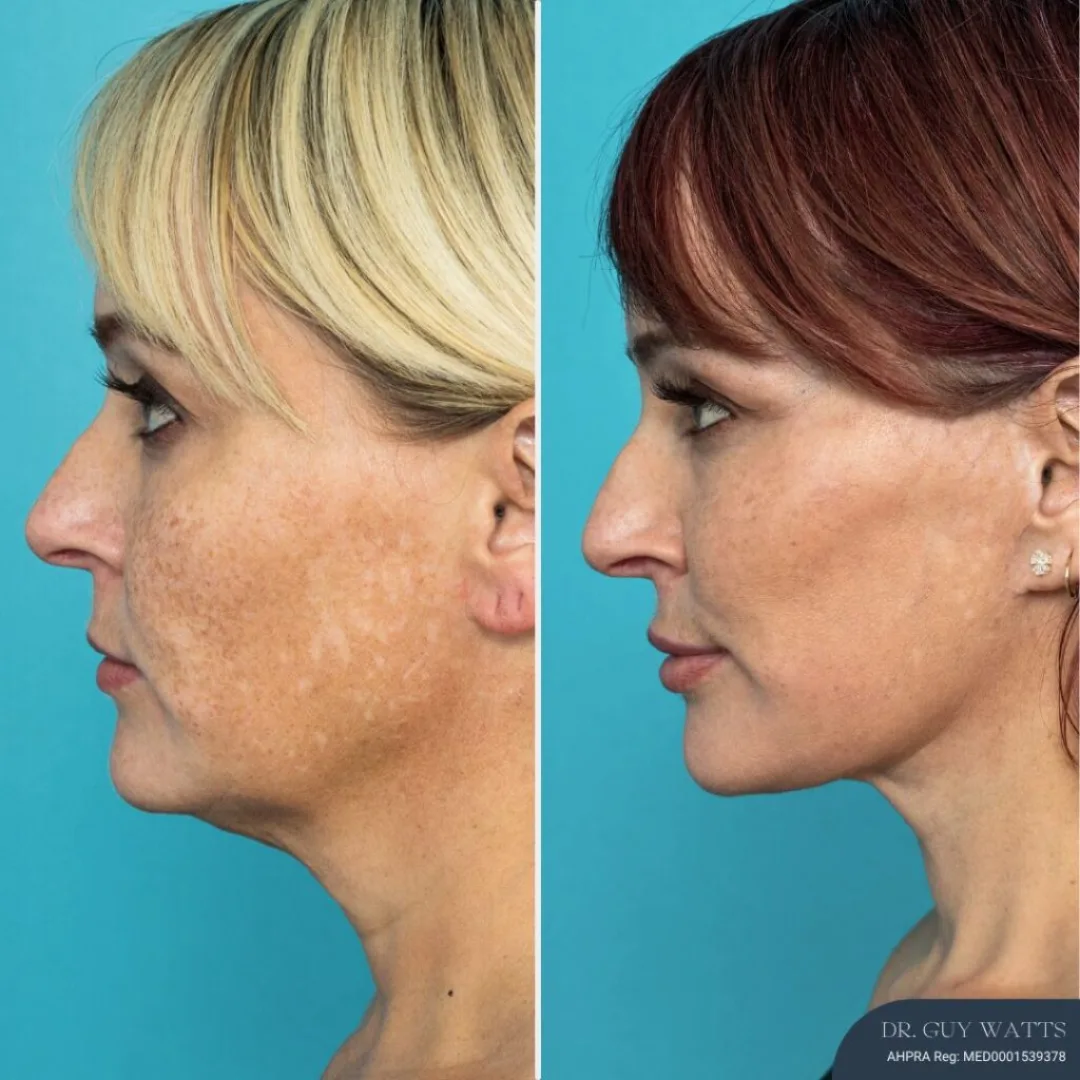 Before and after — Dr. Guy Watts