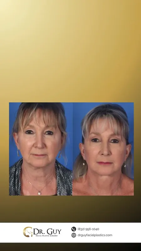 Before and after — Dr. W. Marshall Guy