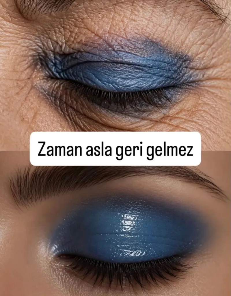 Before and after — Dr. Hakan Kerem
