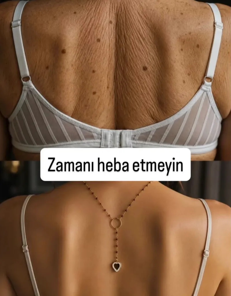 Before and after — Dr. Hakan Kerem