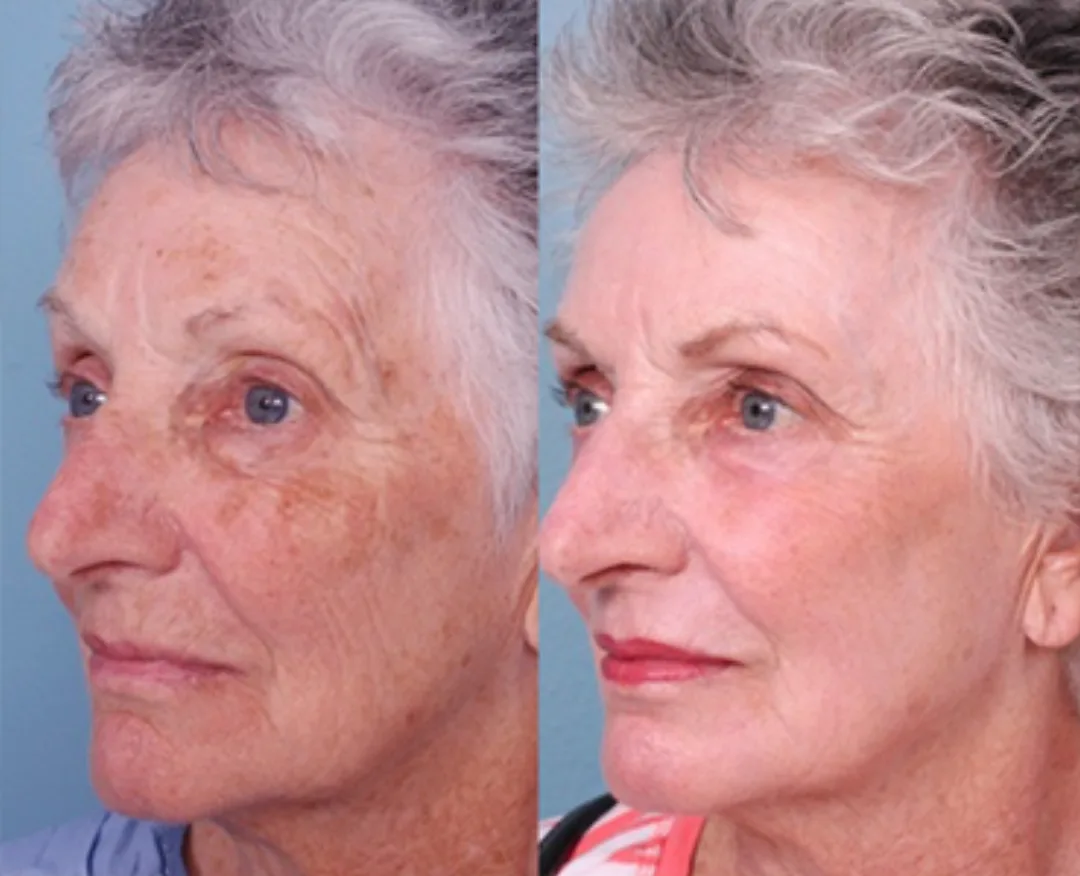 Before and after: Dr. Halema Khan