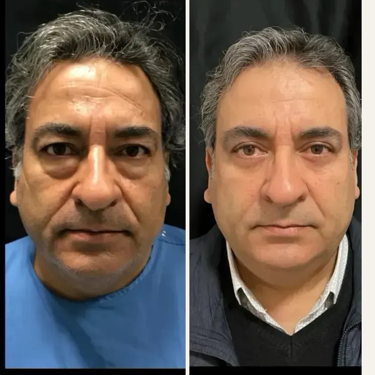 Before and after: Dr. Handan Şimşek Turan