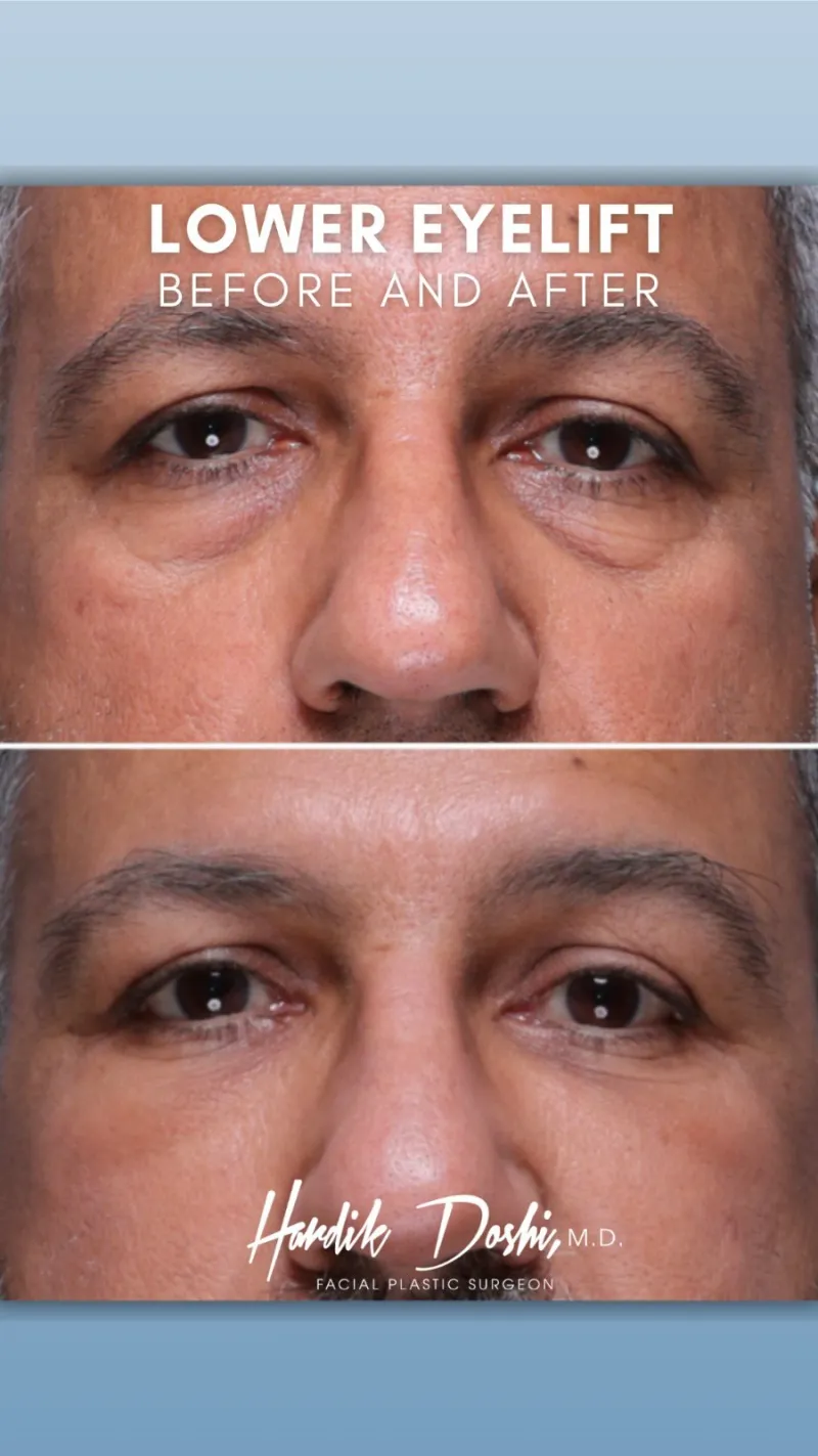 Before and after: Dr. Hardik Doshi