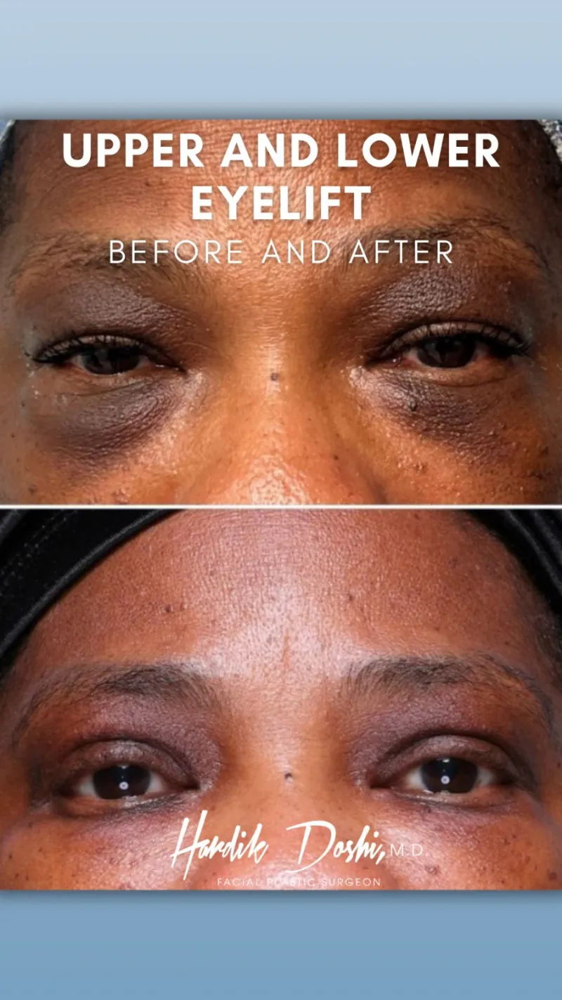 Before and after: Dr. Hardik Doshi