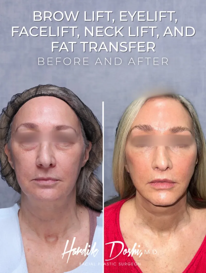 Before and after: Dr. Hardik Doshi