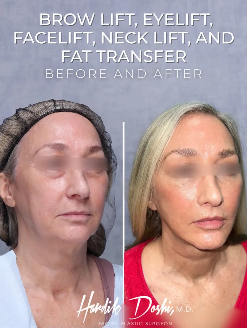 Before and after: Dr. Hardik Doshi