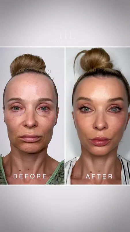 Before and after — Dr. Harrison H. Lee