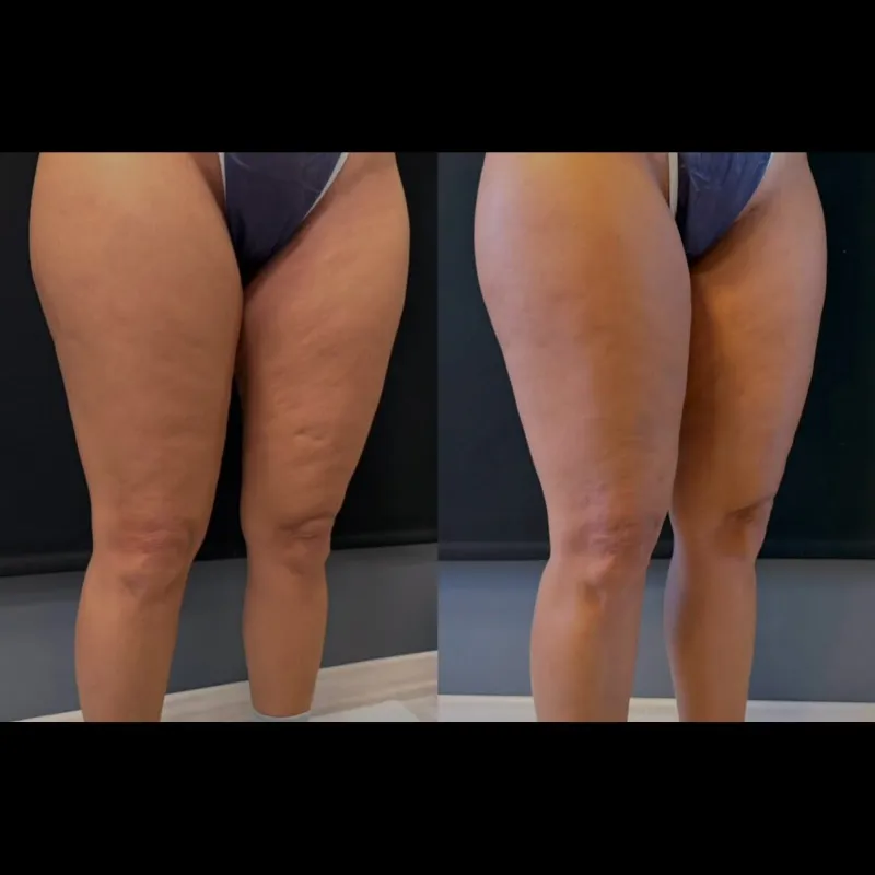 Before and after — Dr. Hasan Büyükdoğan