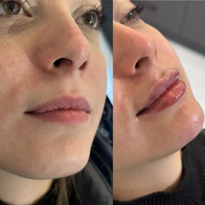 Before and after — Dr. Hasan Kara