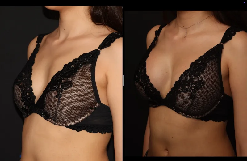 Before and after — Dr. Hasan Kara
