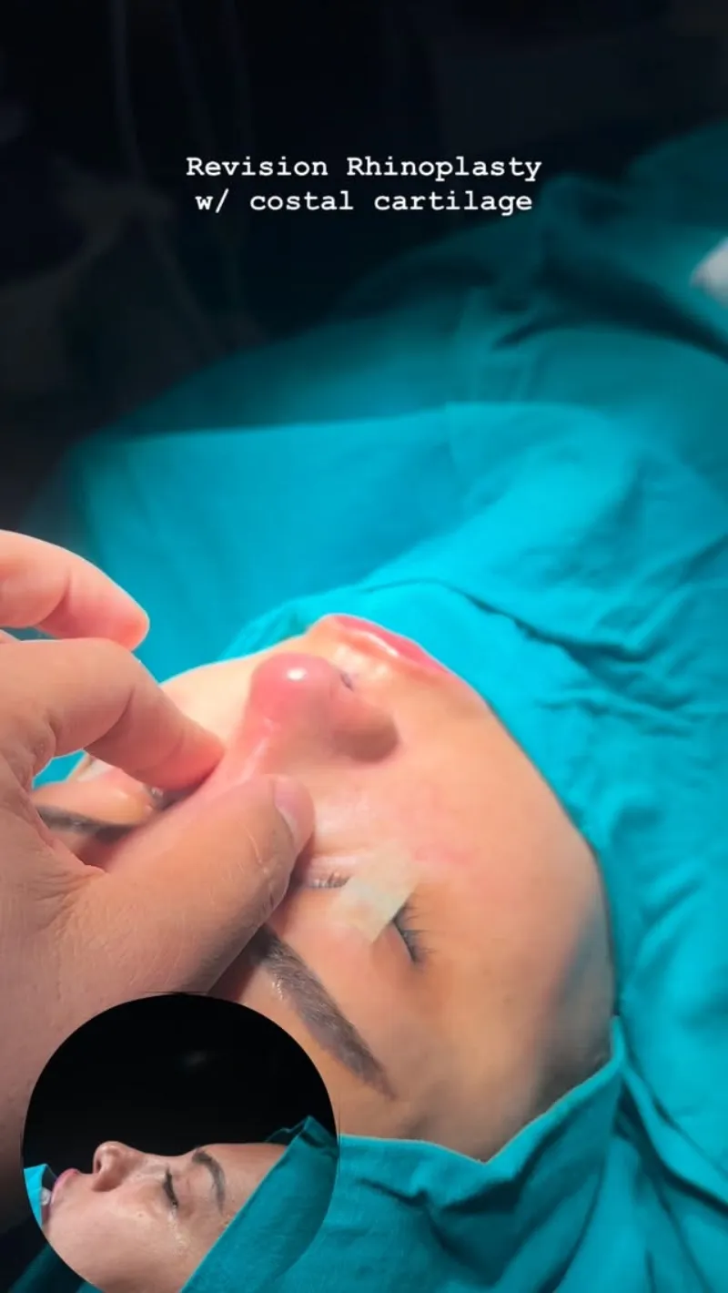 Before and after — Dr. Hasan Kara