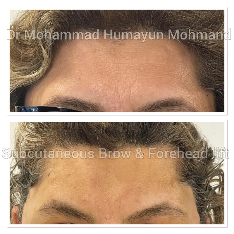 Before and after: Dr. Humayun Mohmand