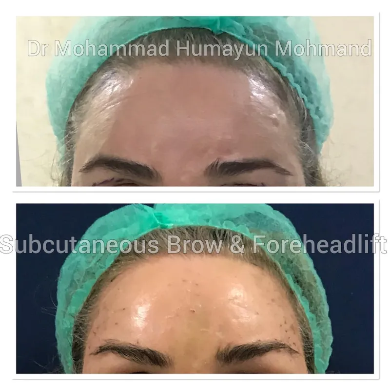 Before and after: Dr. Humayun Mohmand