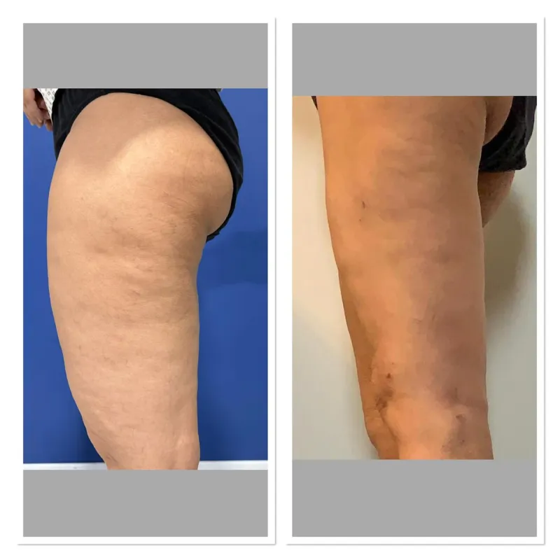 Before and after — Dr. Humayun Mohmand