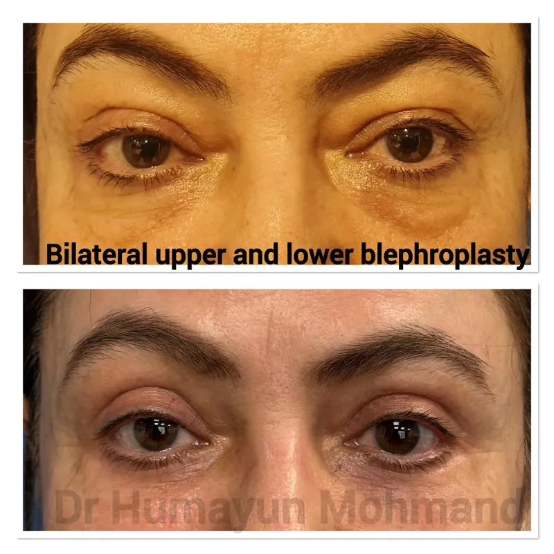 Before and after: Dr. Humayun Mohmand