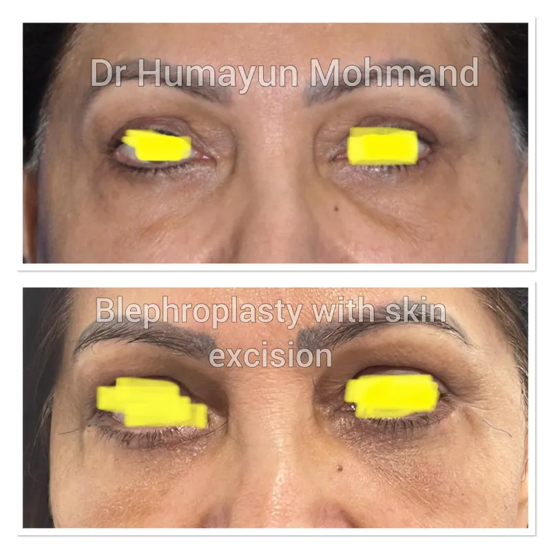 Before and after: Dr. Humayun Mohmand