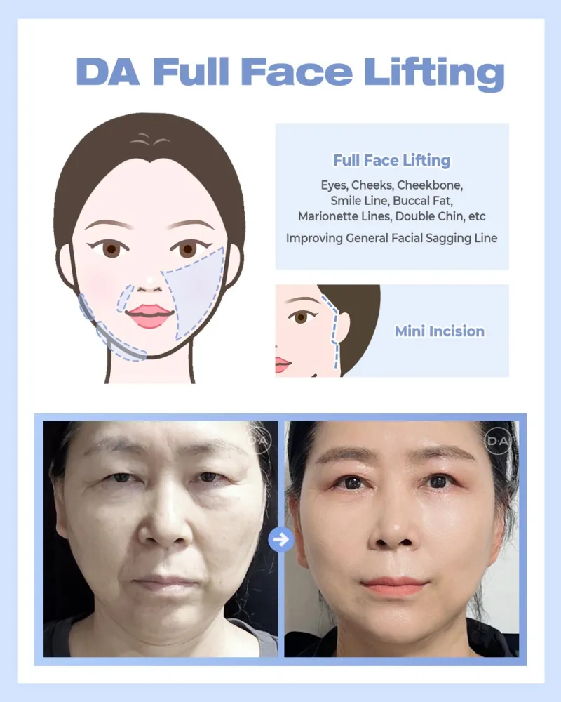 Before and after: Dr. Hyun Sik Yoon