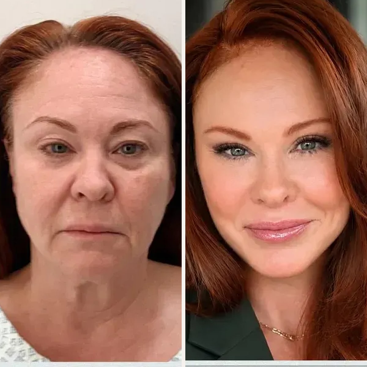 Before and after: Dr. Illich Navarro