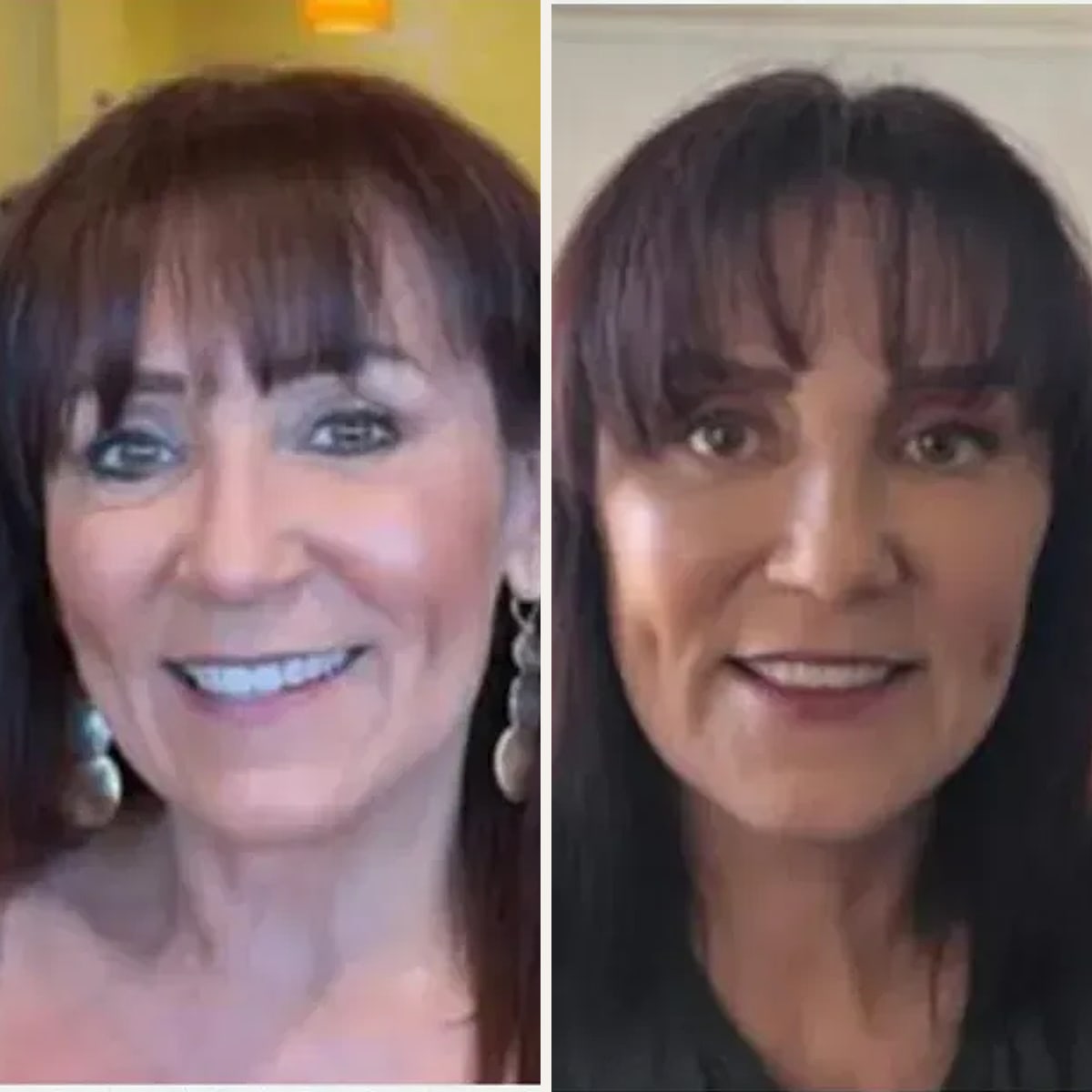 Before and after: Dr. Illich Navarro