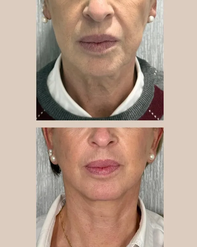 Before and after — Dr. Iñigo Calvo
