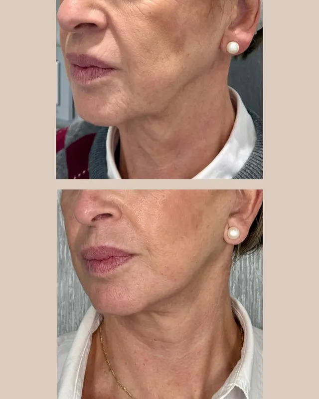 Before and after — Dr. Iñigo Calvo