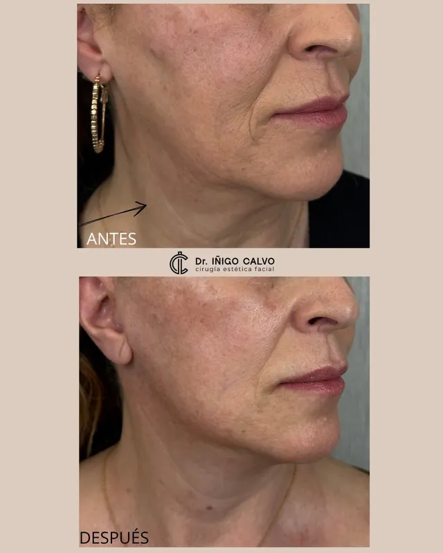 Before and after — Dr. Iñigo Calvo