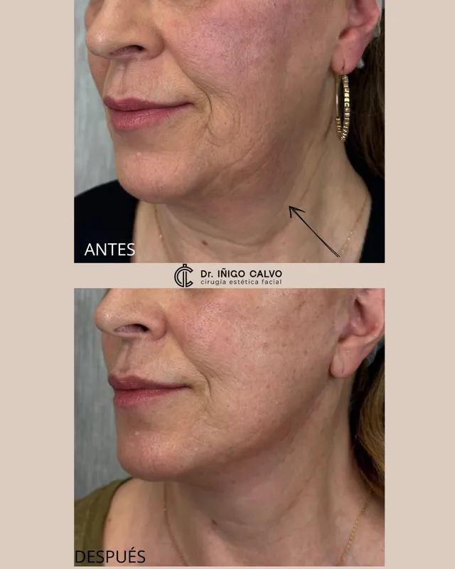 Before and after — Dr. Iñigo Calvo