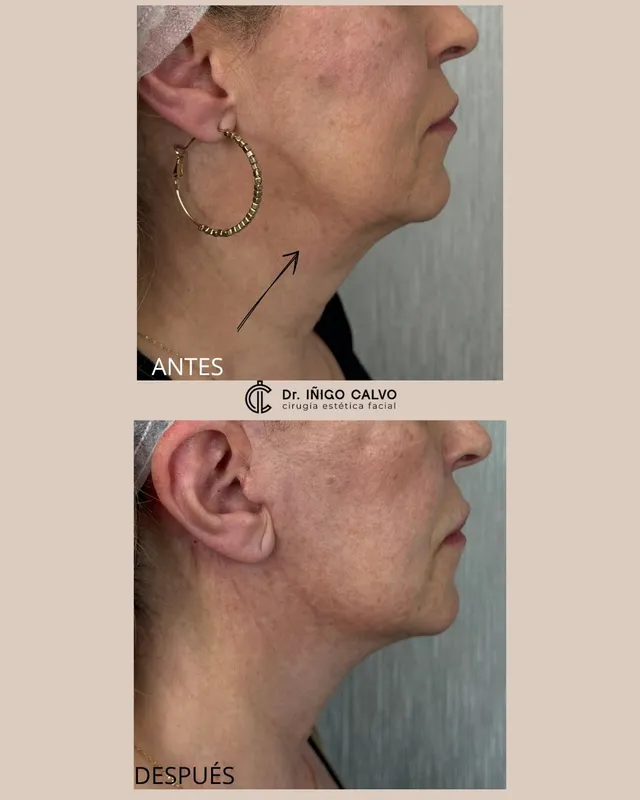 Before and after — Dr. Iñigo Calvo
