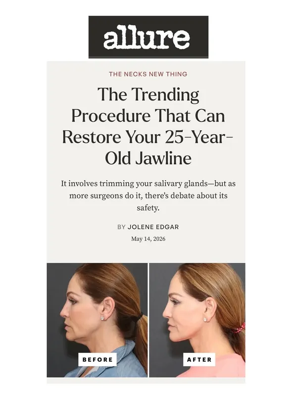 Before and after deep plane facelift, frontal view by Dr. Ira Savetsky