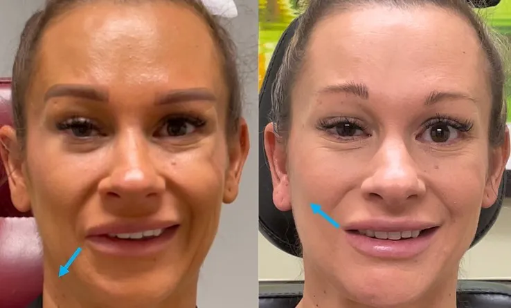 Before and after — Dr. Irene A. Kim