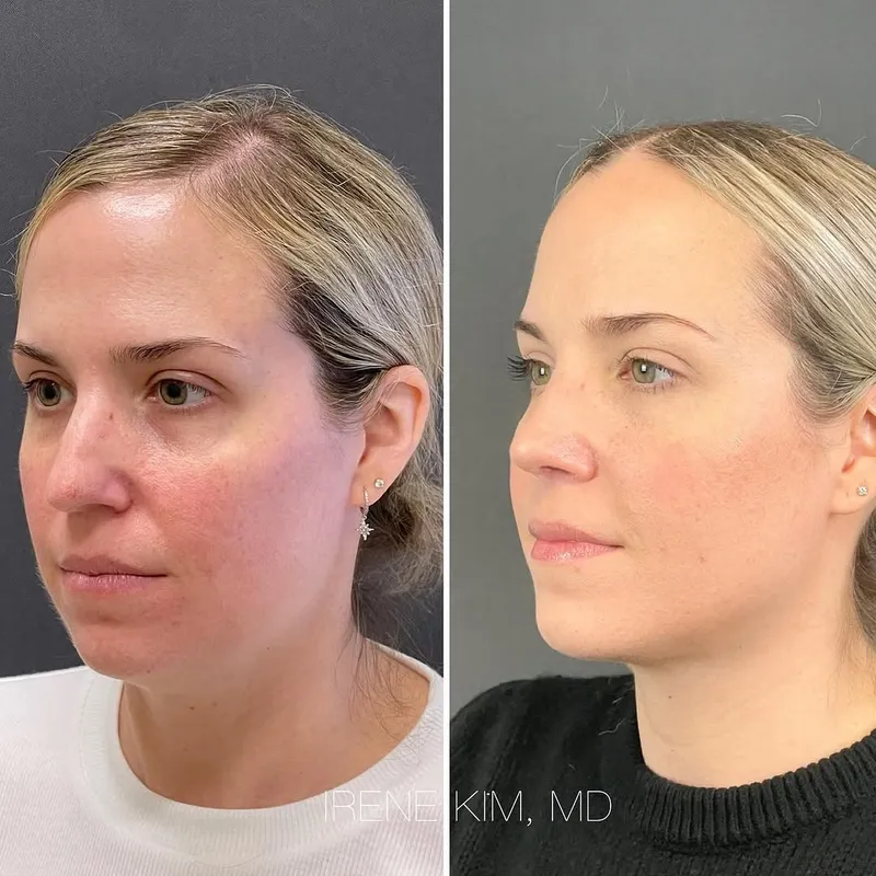 Before and after — Dr. Irene A. Kim