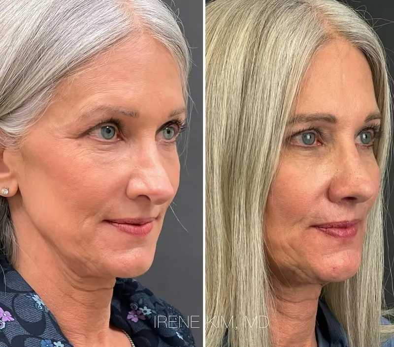 Before and after — Dr. Irene A. Kim