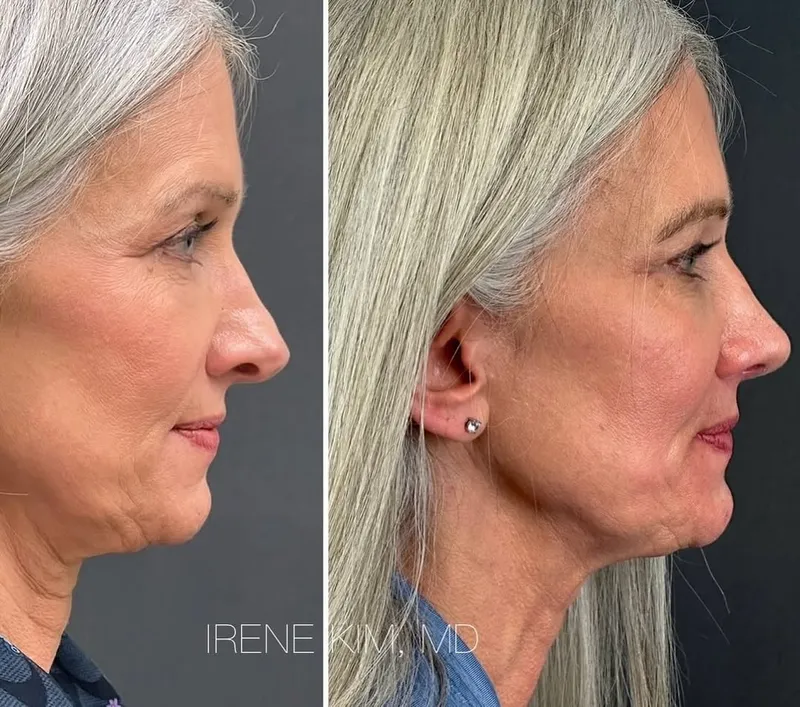 Before and after — Dr. Irene A. Kim