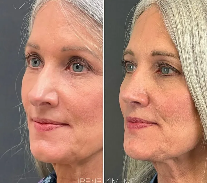 Before and after — Dr. Irene A. Kim